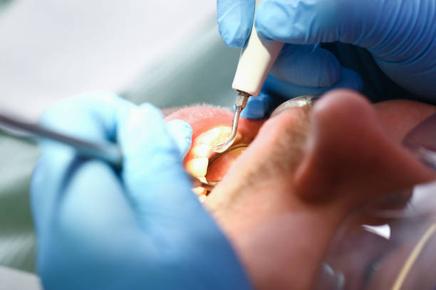 Best Mobile Emergency Dentist in Olney, IL