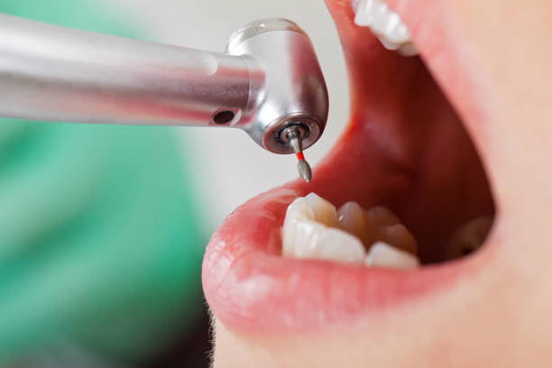 Best Orthodontic Emergency Dentist in Olney, IL